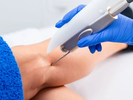 Eliminação de derrames