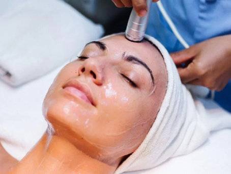 Peeling Quimico