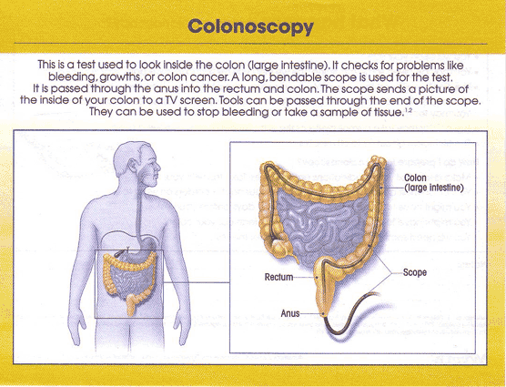 Colonoscopy chart