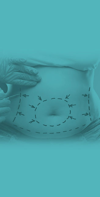 Abdominoplastia.jpg