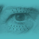 Blefaroplastia.jpg