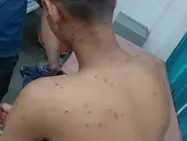 “Two minors shot at the Putia border.”