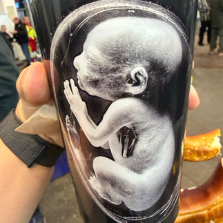 Till Lindemann cups in Hamburg
