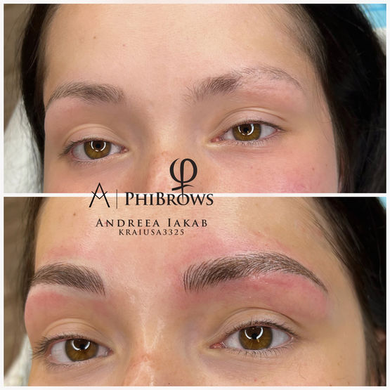 eyebrow scar coverup with microblading