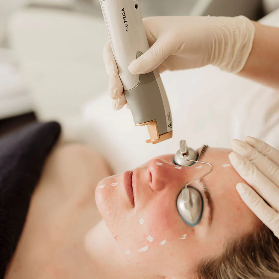 service-laser-genesis-skin-rejuvenation-1.jpg.webp
