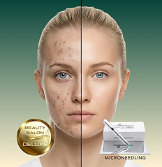 Beauty salon Deluxe Rijeka poster dermapen zelena (1000 x 1000 px).png