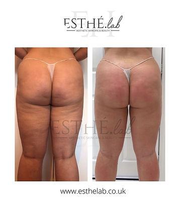 Emilia before and after Arosha.jpg