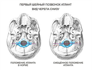 photo.jpg