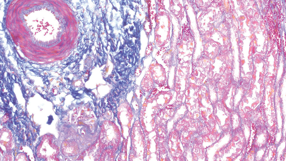 Mallory Trichrome kit