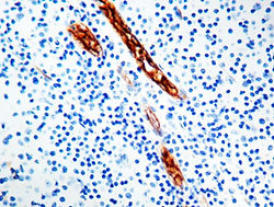 Actin-alpha-Smooth Muscle_1A4.jpg