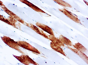 Myosin Skeletal (Fast)