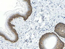 Cytokeratin 14