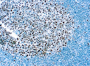 Mismatch Repair Protein 2, MSH2