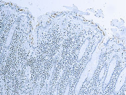Actin-alpha-Smooth Muscle_1A4.jpg