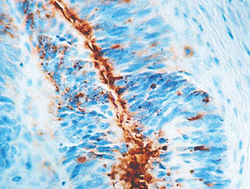 Actin-alpha-Smooth Muscle_1A4.jpg