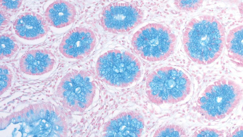 Alcian Blue pH 2.5 kit