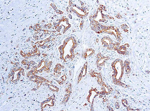 Vascular Endothelial Growth Factor (VEGF)