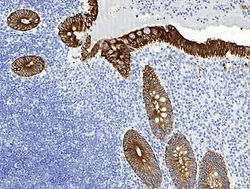 Cytokeratin PAN