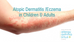 Atopic Dermatitis/Eczema in Children & Adults