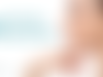 Submental Liposuction: Bye Bye Double Chin