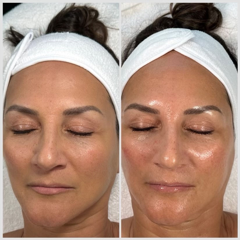 Before and after facial skincare shows a woman's face with closed eyes and hair wrapped in a towel. Left: matte skin; Right: glowing skin. Best Facials Near Me