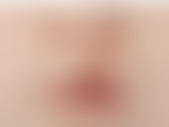 Can Rhinoplasty Correct Childhood Injuries?