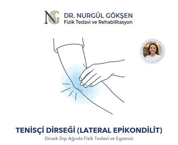 Dirsek Dışında Zonklayan Ağrı: Tenisçi Dirseği (Lateral Epikondilit)