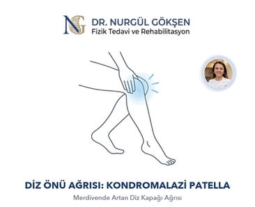 Merdivende Artan Diz Önü Ağrısı: Kondromalazi Patella