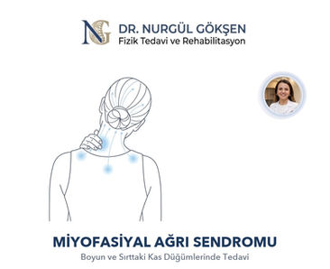 Boyun ve Sırtta Geçmeyen Kas Gerginliği: Miyofasiyal Ağrı Sendromu