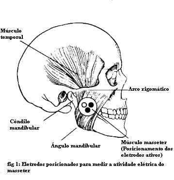 biofeedback_004_Masseter.gif