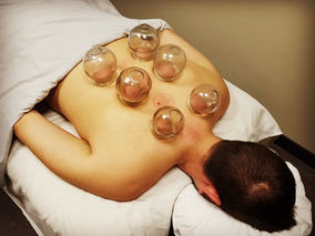 Science of Cupping Therapy
