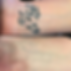 laser tattoo removal before and after