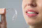 Invisalign (1).jpeg