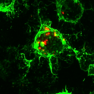4-21-1_QD-bEV_Lectin_60x_6_0.1-MaxIP_RGB