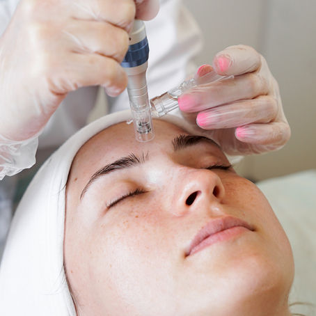 Gezichtsbehandeling (Facial) in Nederland – Complete Gids voor Stralende Huid