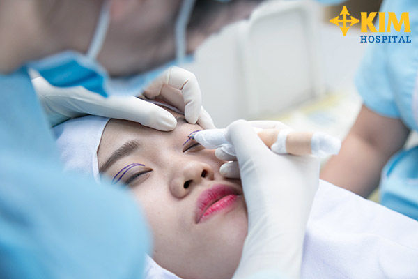 Bấm mí Hàn Quốc khắc phục những nhược điểm nào của mắt 2