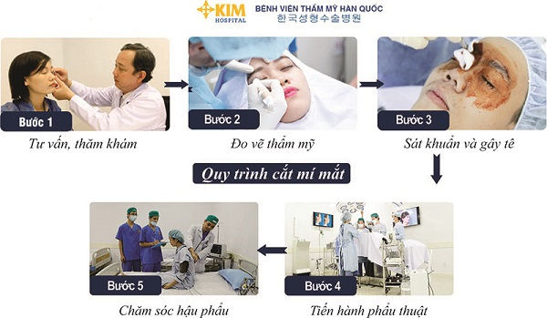 Mí mắt nhiều da chùng nên cắt hay nhấn mí?