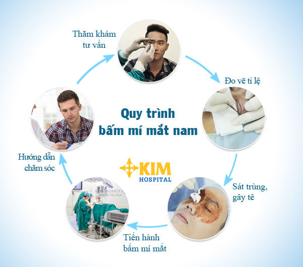 Chi phí bấm mí cho nam tại bệnh viện Kim giá bao nhiêu