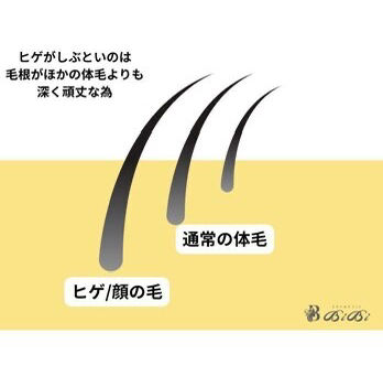 なぜひげ脱毛は時間がかかるのか?