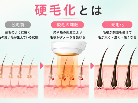 硬毛化とは⁉ 硬毛化を治すには美容電気脱毛！｜町田脱毛【エステBiBi】