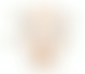 VIO脱毛されていますか？