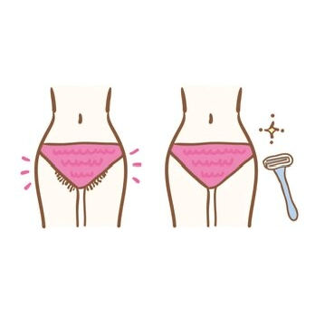 VIO脱毛について