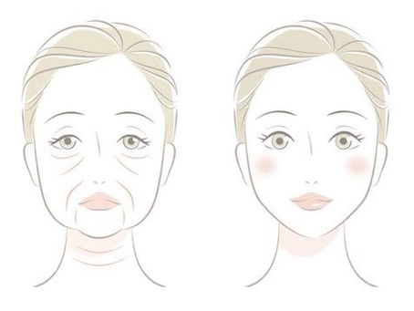 たるみ改善!原因編