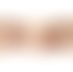 眉毛は美容電気脱毛!