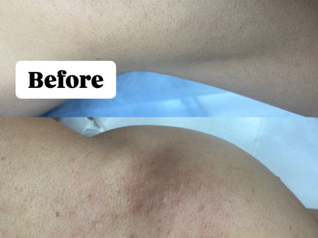 毛が増えることはありません！