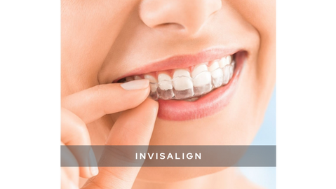 invisalign bergen county