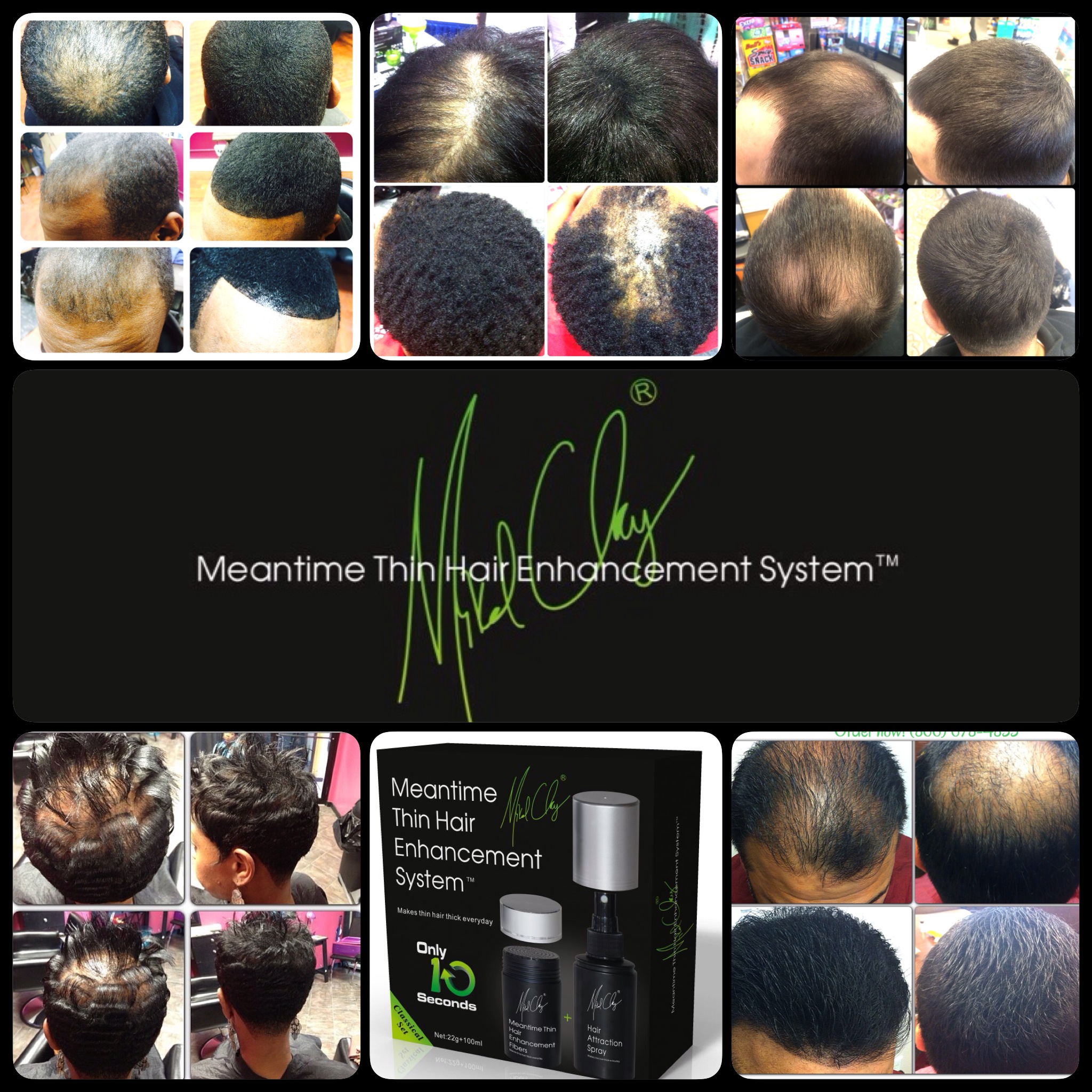 Thin Hair Enhancement Www Thinhairenhancement Mikal Clay