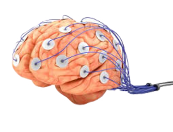 cerebro_edited.png
