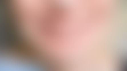 SOINS POUR VOTRE TRAITEMENT D'ORTHODONTIE