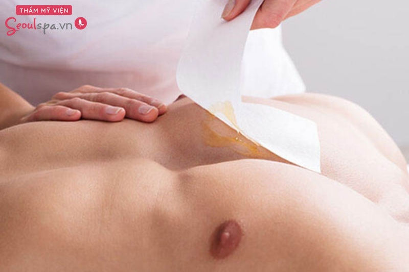 Waxing giúp loại bỏ lông triệt để trên cơ thể nam giới
